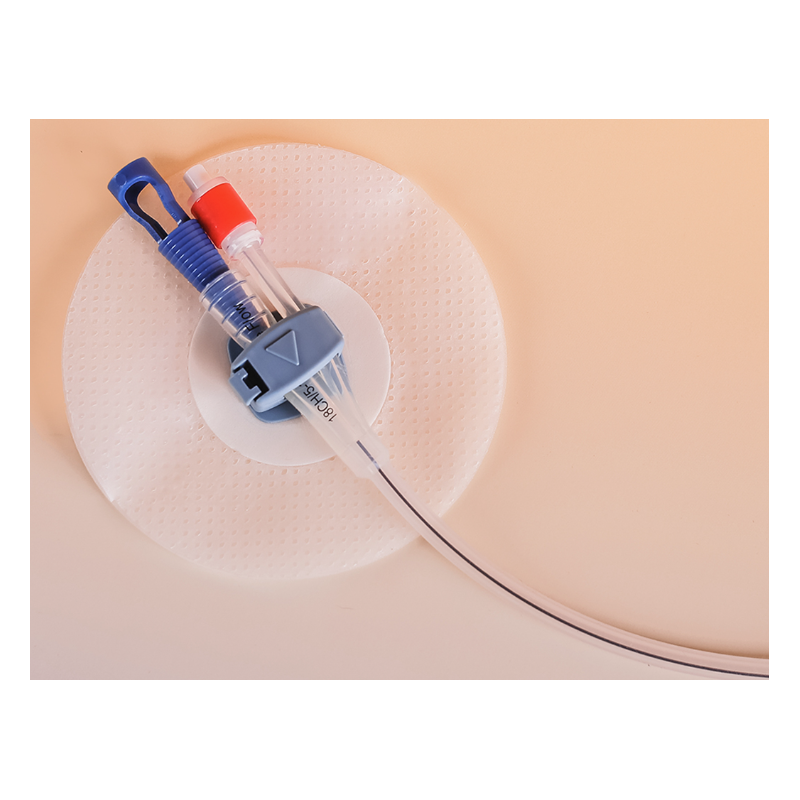 Fixation de cathéter Ugo-Fix non stérile