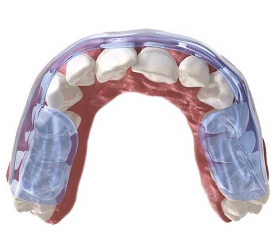 Aqualizer® gouttière de dentition Ultra 2mm medium Aqualizer® gouttière de dentition Ultra 2mm medium