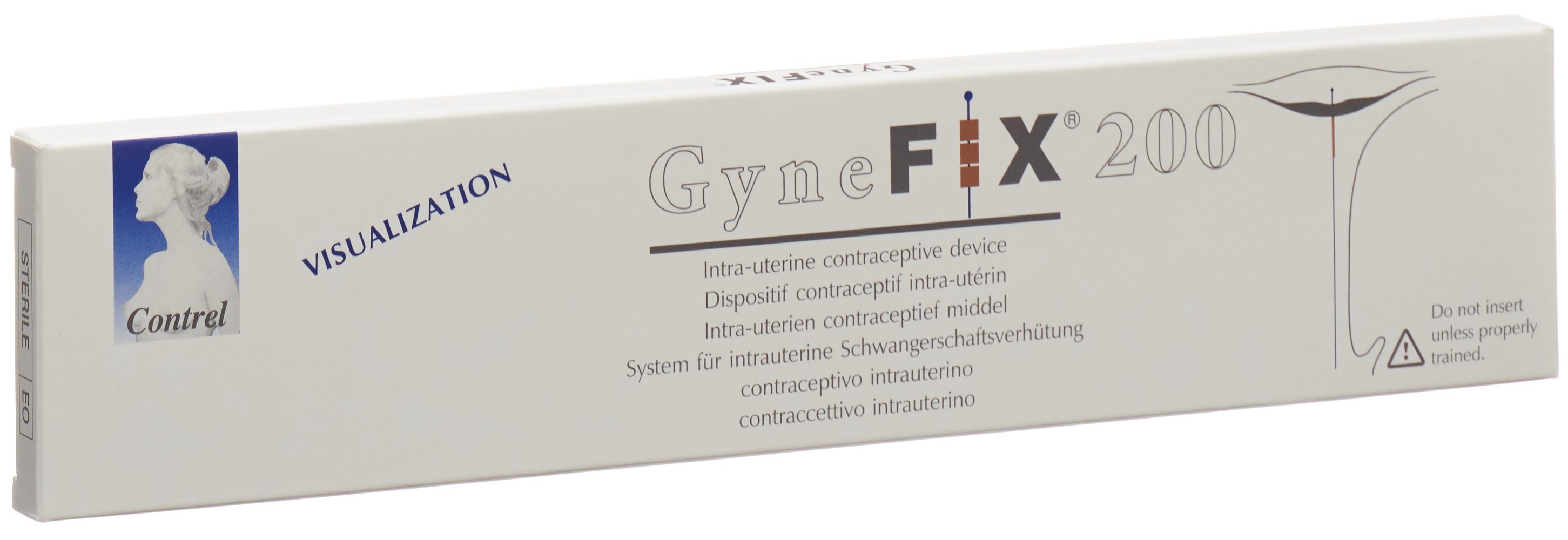 GYNEFIX 200 IUP GYNEFIX 200 IUP